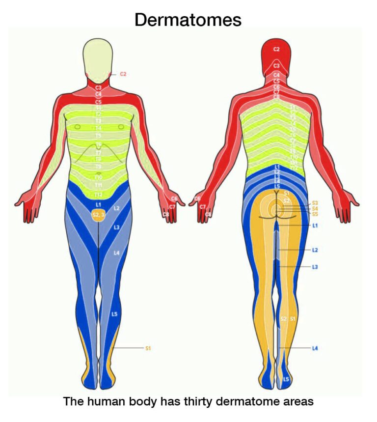 Dermatomes Sss Shingles Support Society